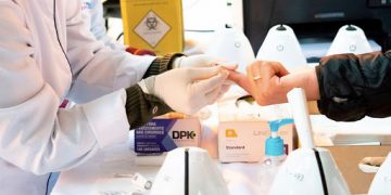 Sul de Minas deverá receber testes rápidos para detectar coronavírus