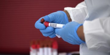 Ex-deputado Caio Nárcio morre aos 33 anos com Covid-19