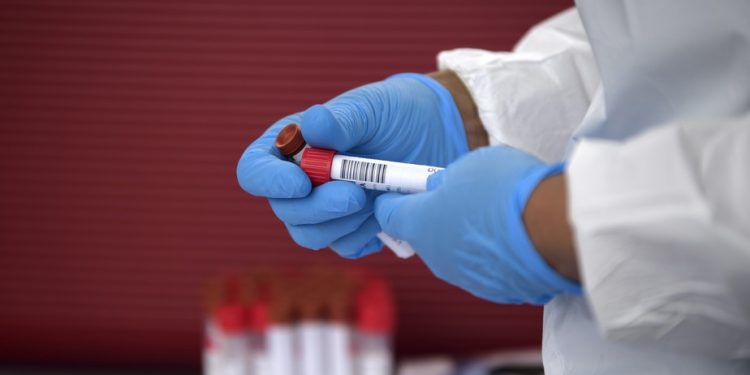 Ex-deputado Caio Nárcio morre aos 33 anos com Covid-19