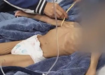 Criança fica 40 dias sem comer em SP, pai queria fazê-la morrer de fome