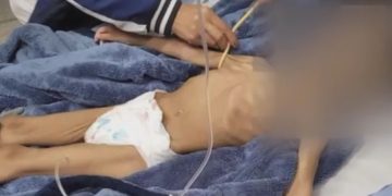 Criança fica 40 dias sem comer em SP, pai queria fazê-la morrer de fome